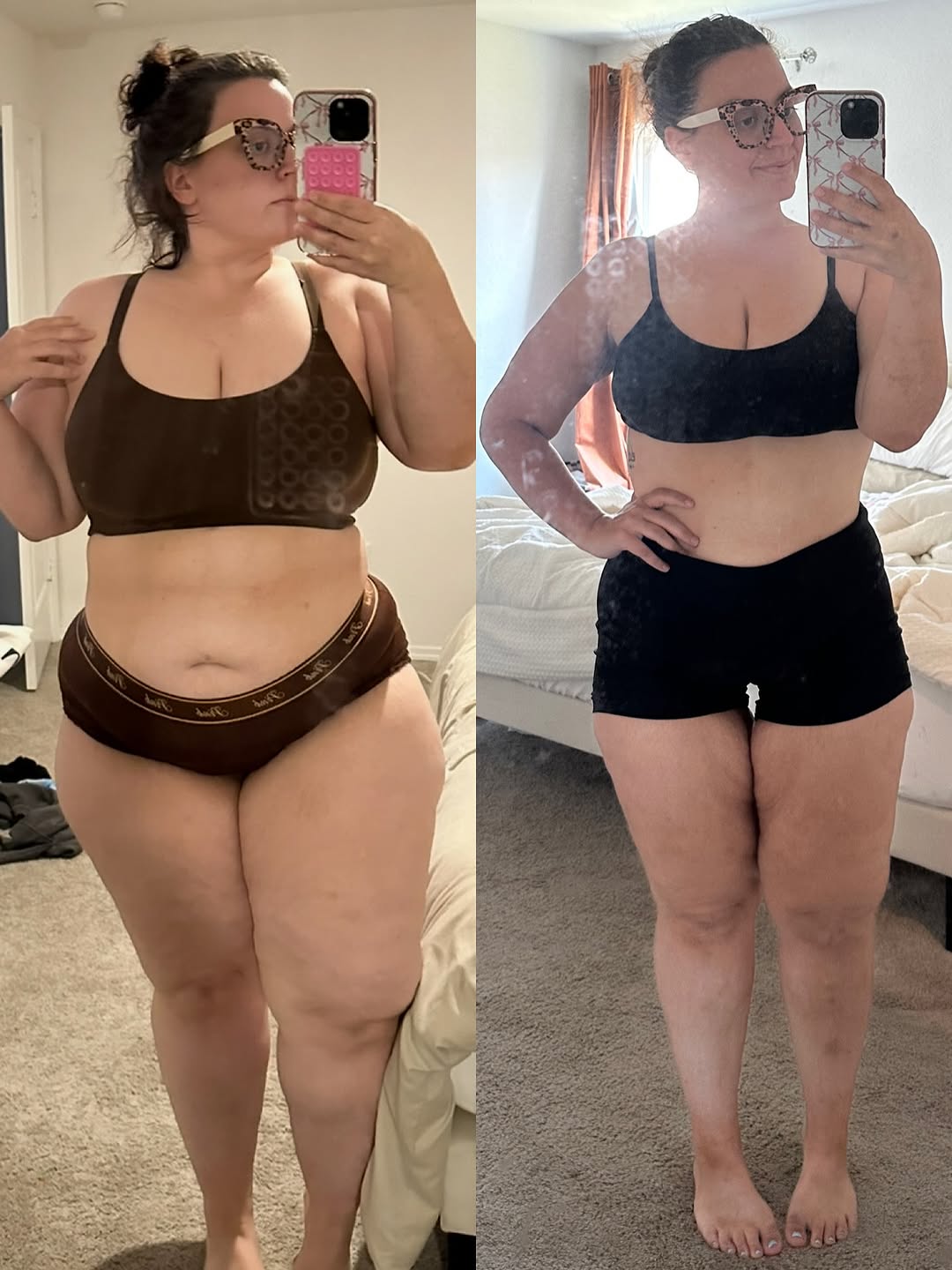 Patient transformation - Before and After